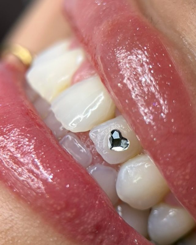 Single crystal heart tooth gem by Tia Berry, Vancouver
