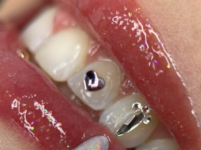 Crystal heart and butterfly tooth gems by Tia Berry, Vancouver